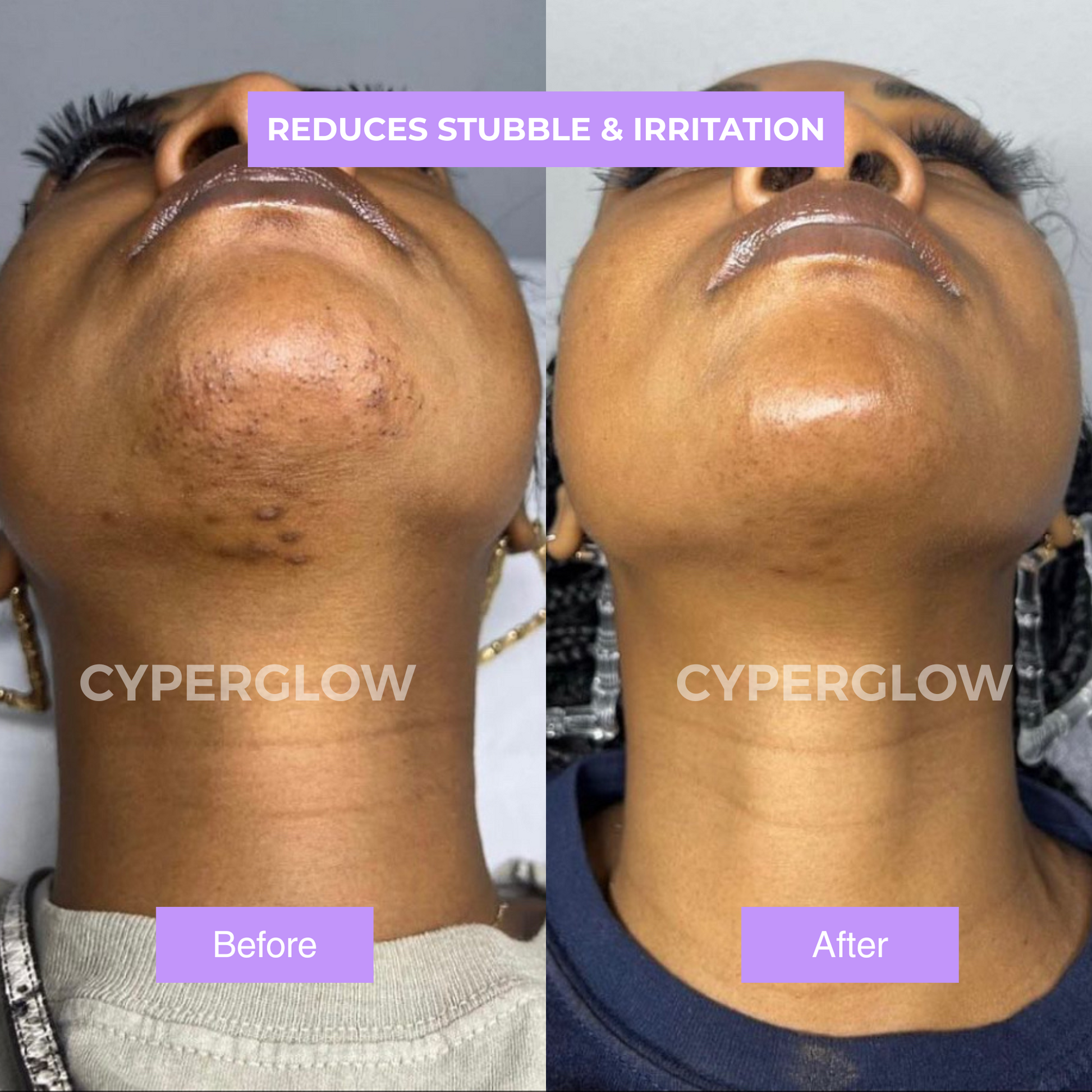 CyperGlow™ - Cyperus Rotundus Skin Serum