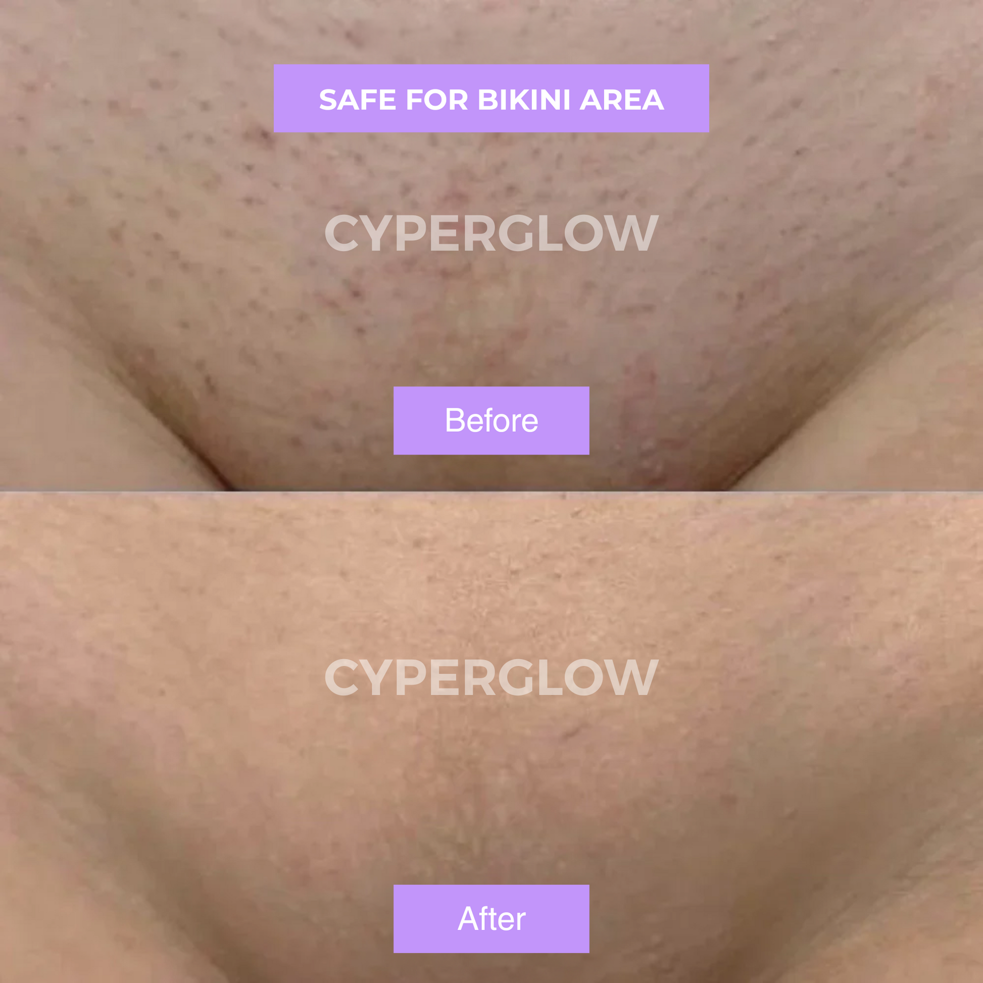 CyperGlow™ - Cyperus Rotundus Skin Serum